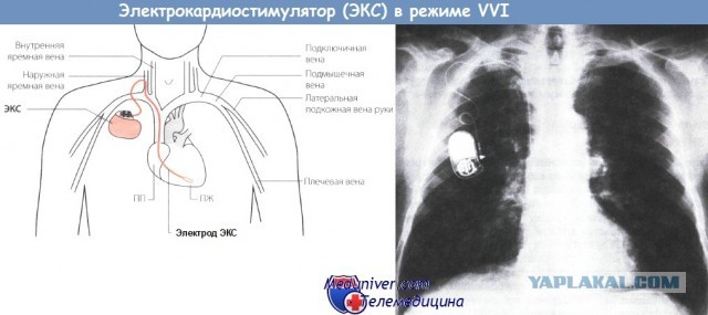 «Ой, кажется, я запихнул туда не тот резистор»