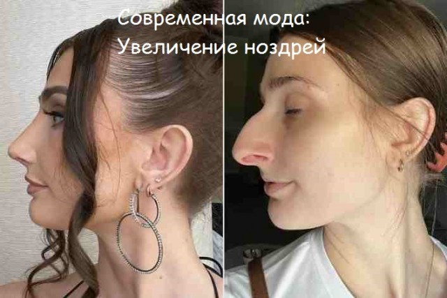 Носопырки