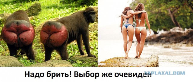 Движение женщин против эпиляции.
