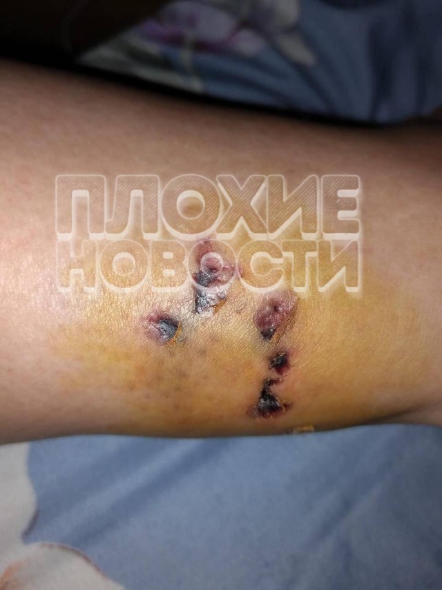 Жуткие кадры: В Хабаровске бродячие собаки едва не растерзали девушку