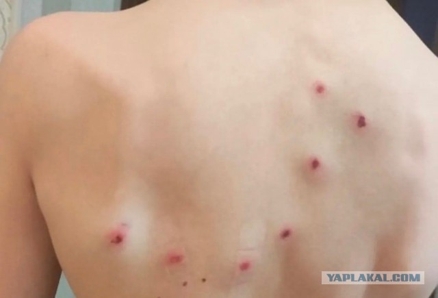 Десятиклассник- мигрант стрелял в 13-летнего школьника из страйкбольного автомата