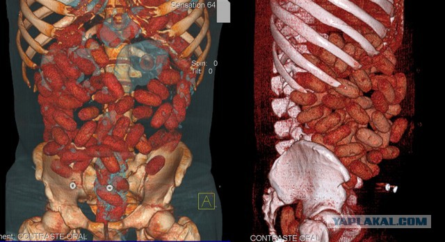 Запрещенные предметы, конфискованные в аэропортах