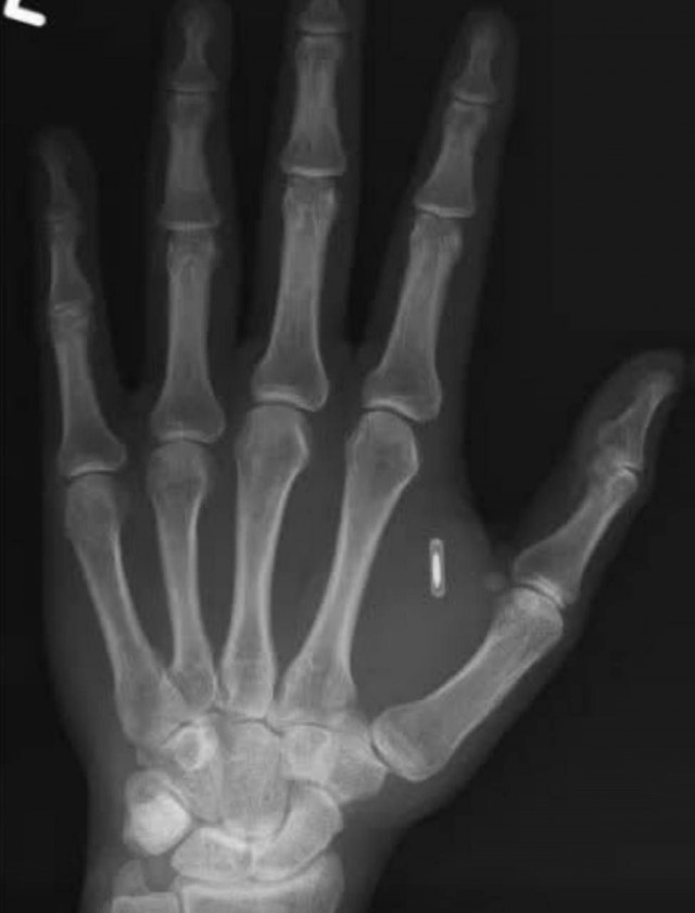 Фокус-покус.