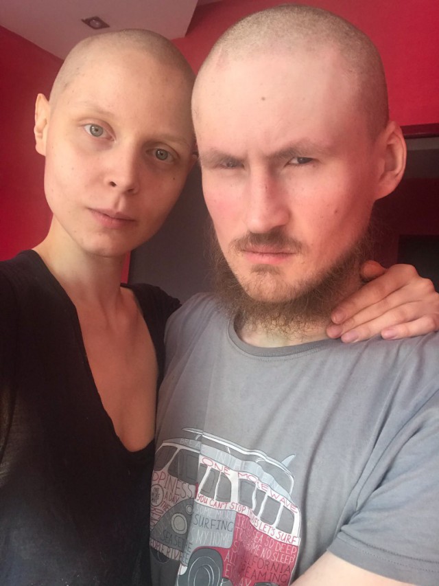 Подборка фриков, которые добровольно себя изуродовали "для красоты"