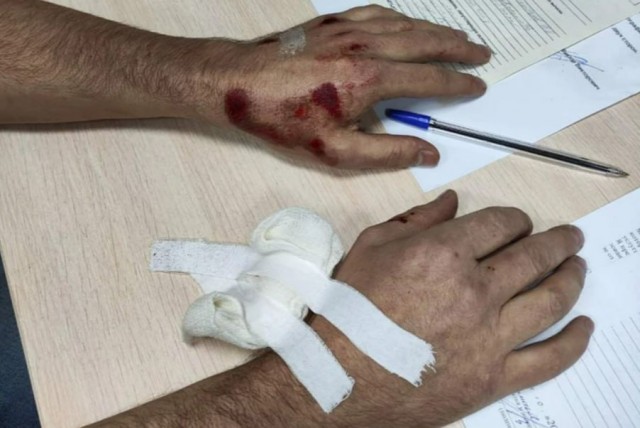 В Самаре водитель протащил прохожего по дороге за замечание по поводу скорости движения во дворе