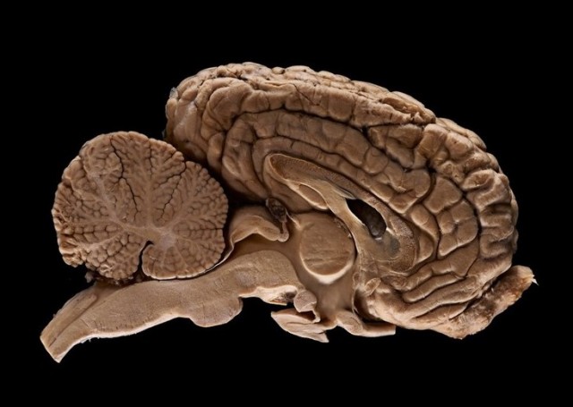 Человеческий мозг - интересные факты