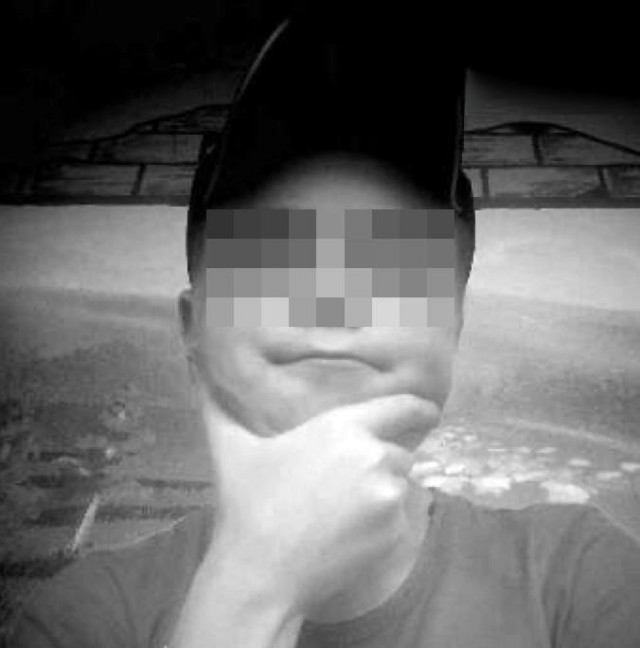 В Москве умер пациент стоматологии от потери крови после удаления зуба