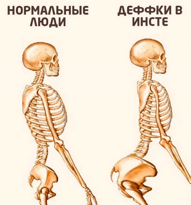 Бредзона 29.11.20