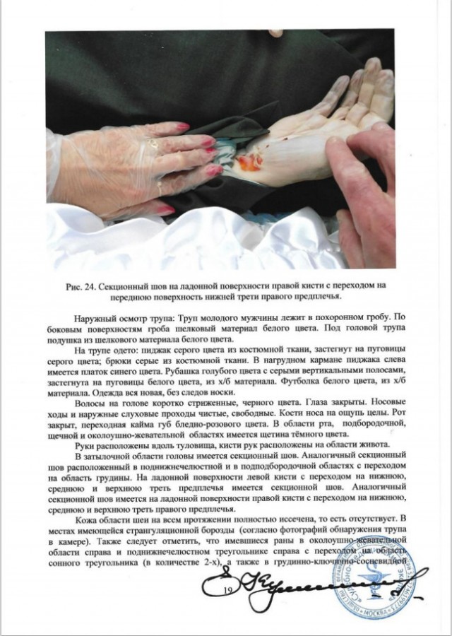 Экспертиза возможного убийства Тесака в Челябинском СИЗО №3