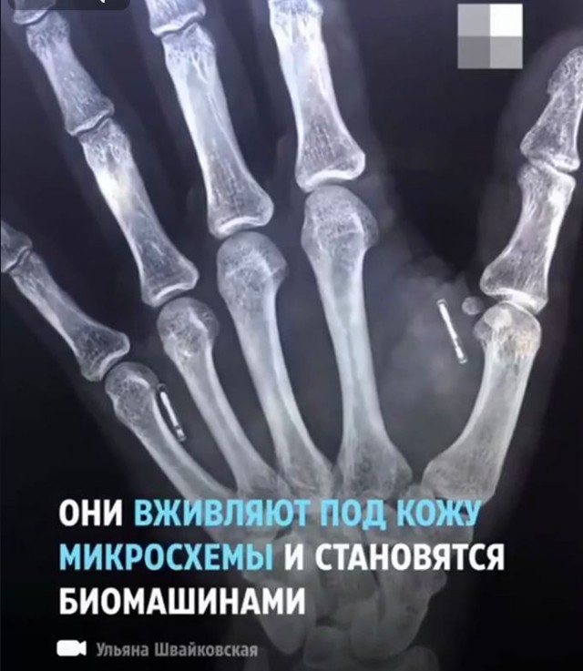 Пандемия съехавших крыш - разновидности болезни. Россия и мир. Часть 41.