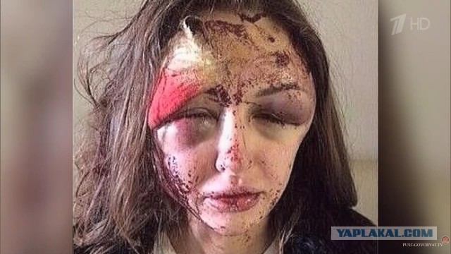 Поклонник избил журналистку телеканала «Россия 1»