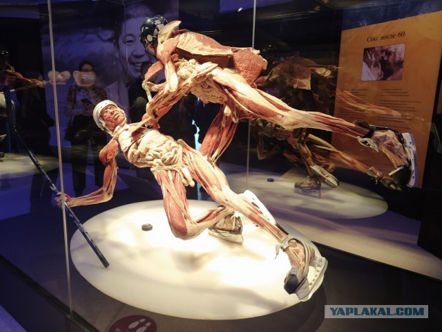 Посетил выставку Body Worlds на ВДНХ