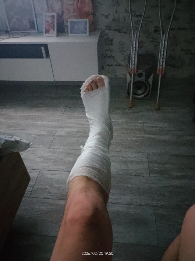 Гололёд.