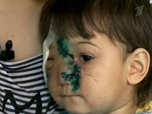 В Ярославской области полицейский застрелил собаку, охранявшую спящего хозяина.