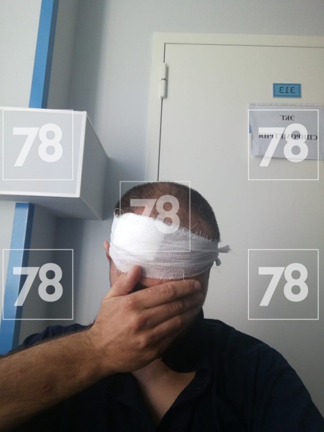 Трое приезжих избили мужчину, который заступился за девушку в Колпино