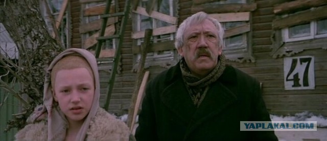 Девушка, страдающая алопецией, попросила мужа побрить ее наголо