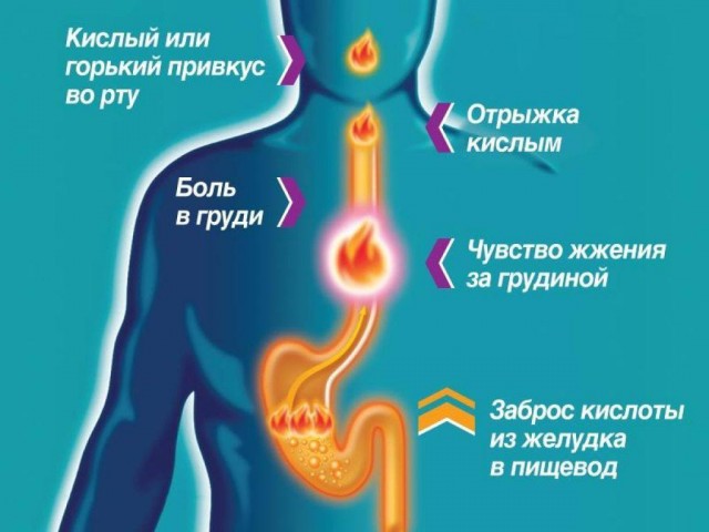 Пандемия съехавших крыш - разновидности болезни. Россия и мир. Часть 43.