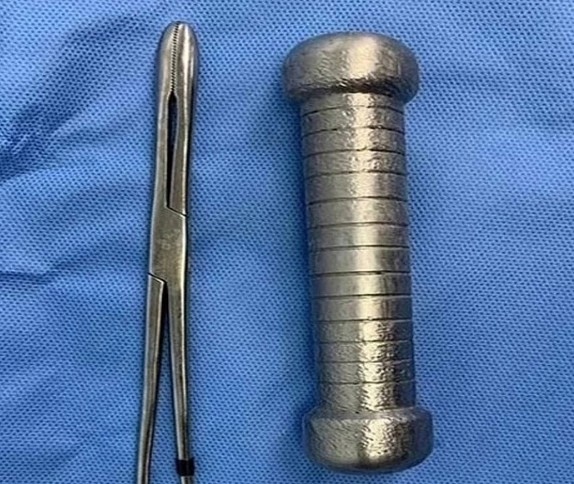 В Бразилии мужчина по непонятным причинам поместил 2 килограммовую гантель себе в анус.