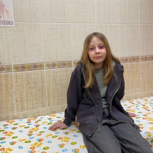 Мать года неделю лечила дочь от «редкой болезни» с розовыми кругами под глазами — в итоге оказалось, что всё это… фломастер
