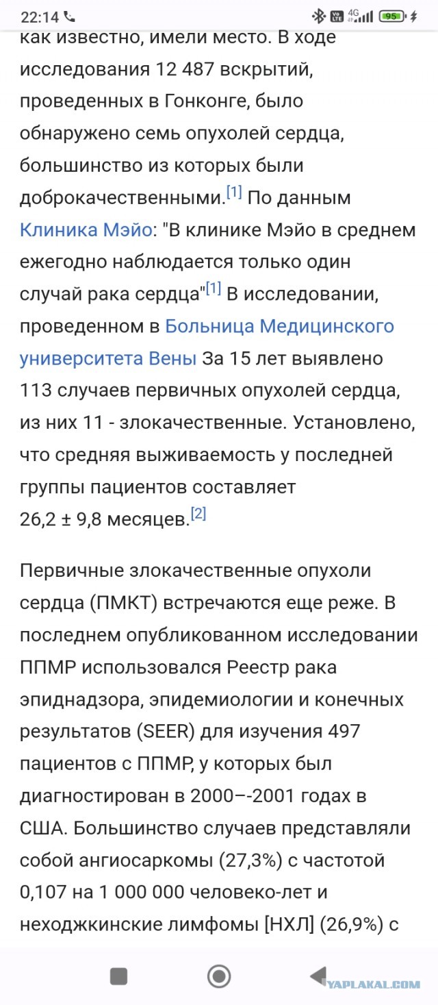 Цирроз + асцит