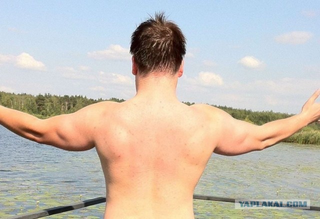 Синдром "чёткости"