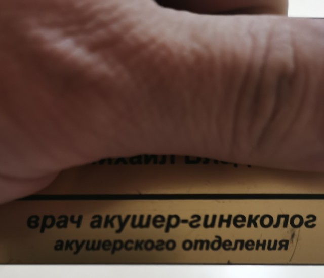 Кесарево сечение