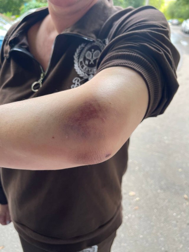 В подмосковном Одинцово банда на самокатах напала и ограбила женщину