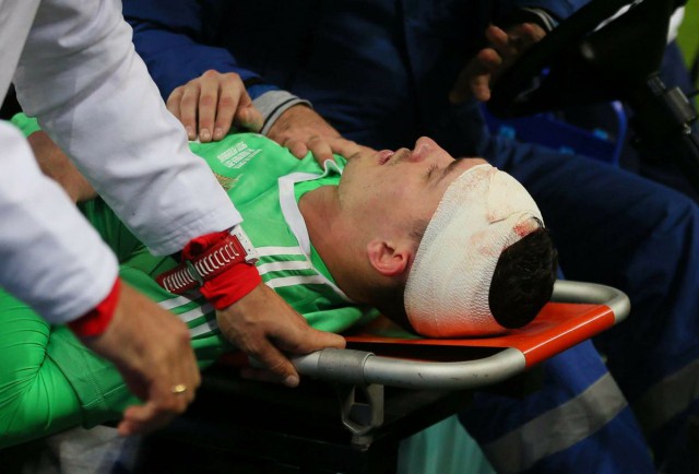 Вратарь сборной России получил тяжелую травму во время матча с Испанией