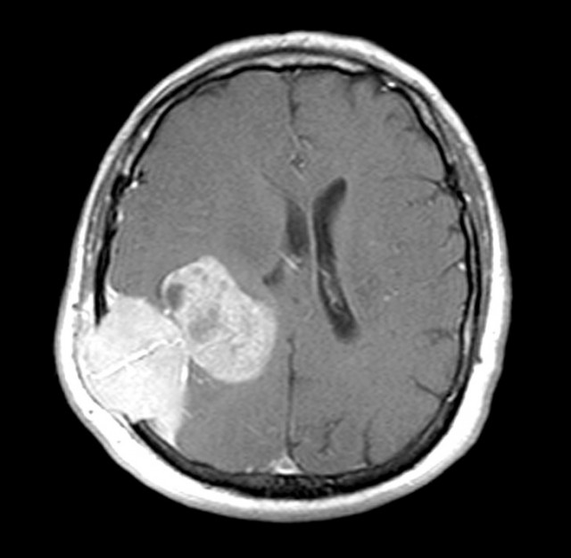 16 снимков человеческого тела, которые нельзя сделать обычным фотоаппаратом
