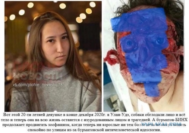 Зоошиза