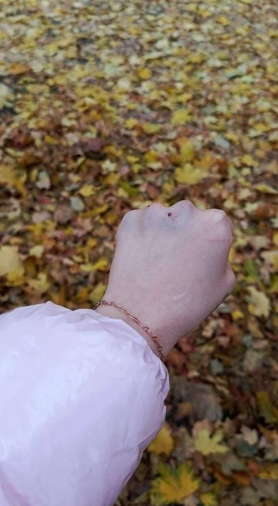 В Иванове мигрант-таксист избил пассажирку из-за низкой оценки и вырвал ей ногти