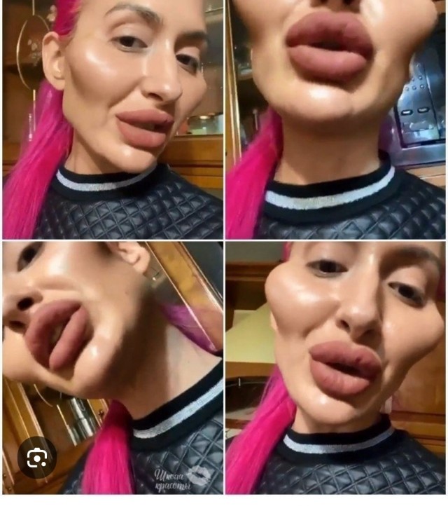 Рыжая против пластики