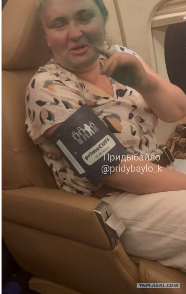 Переломы рассосались — Милашина и Немов уже в московской больнице