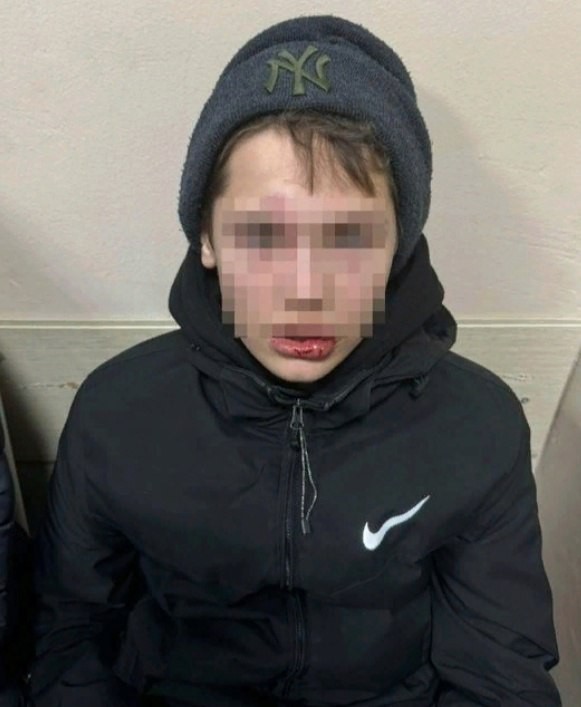 В Новосибирске мужчина избил 14-летних подростков на катке