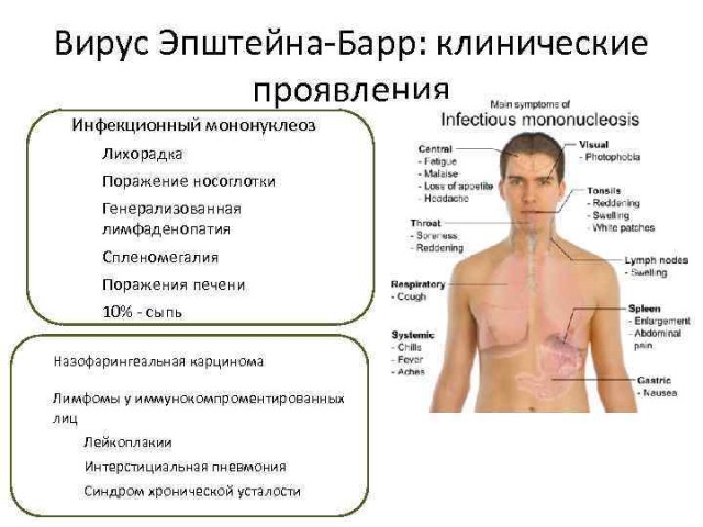 Пандемия. Коронавирус. Россия и мир. Последняя информация. Часть 21