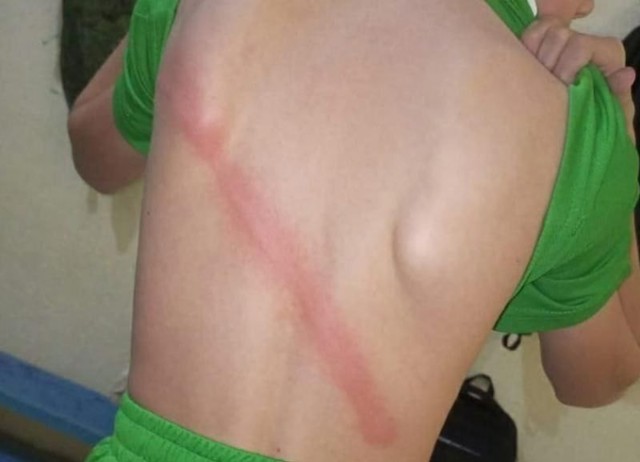 12-летний ученик кадетской школы в Ставрополе пришел домой со следами от плети