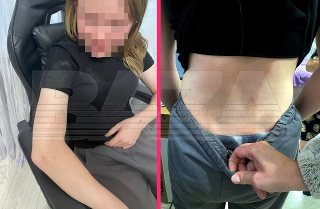 В Орске подростки жестоко избили девочку в день ее рождения