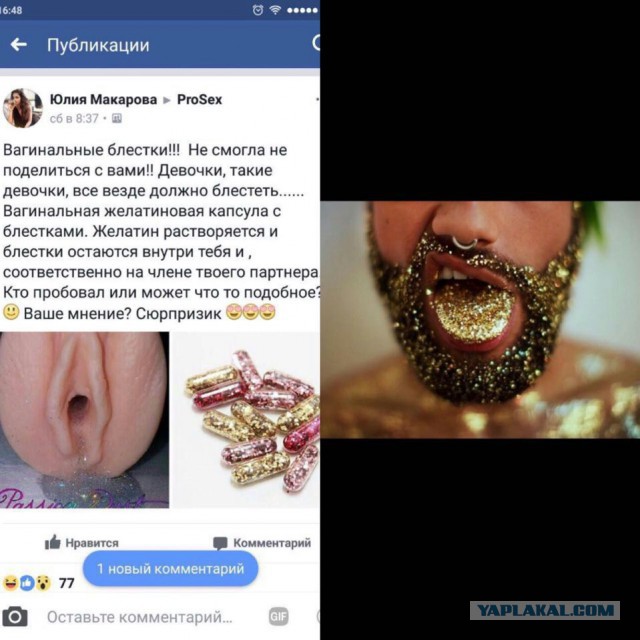 Вагинальные блестки