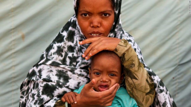 17 печальных фактов об ожирении, от которых многим срочно захочется похудеть