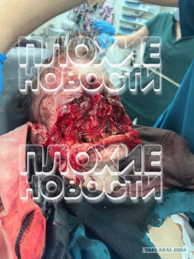 Хозяин хаски, напавших на ребёнка в Сочи, не кормил их 12 дней