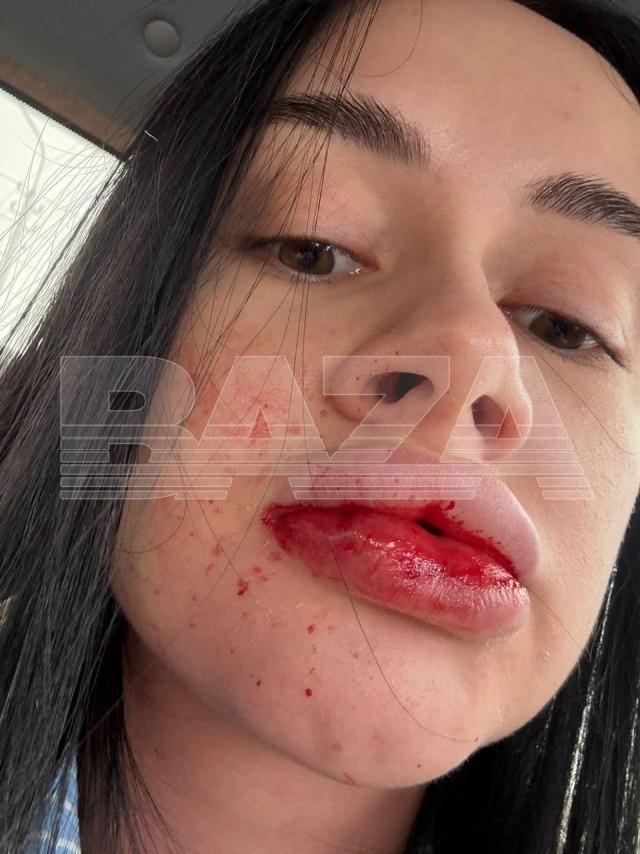 Вернувшийся с СВО житель Нижневартовска уже несколько месяцев преследует свою бывшую жену и избивает её