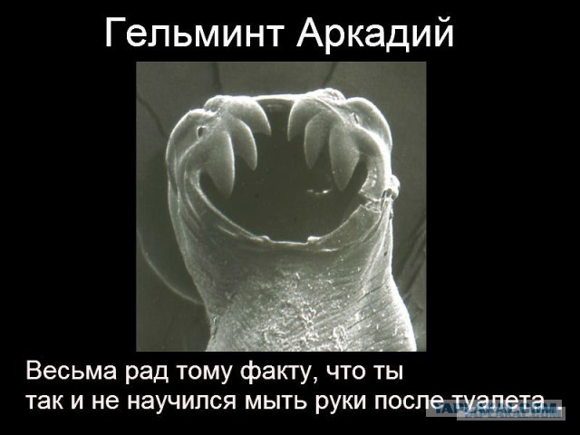 Красноярские хирурги достали из печени мужчины огромного червя