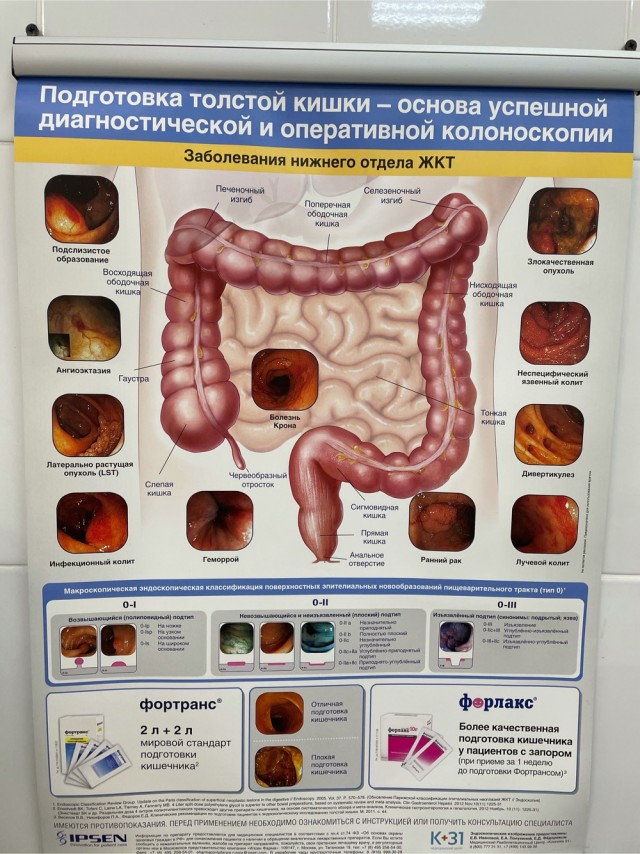 7 фактов о *овне
