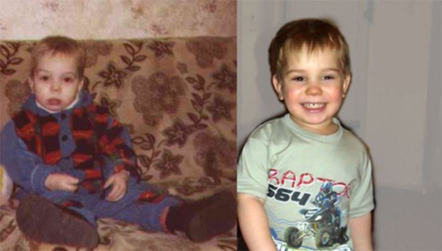 Фото детей до и после того как их взяли из детдома