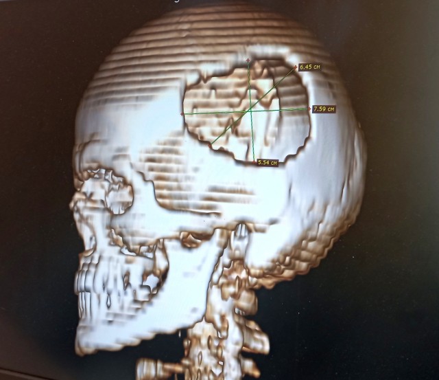 Т8000
