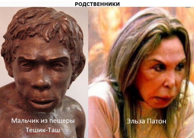 Пластиковые бабки-ёжки: фото бывших красавиц до и после того, как их состарила и изуродовала пластика