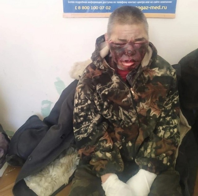 Женщина умерла после двух суток в лесу в -50 С
