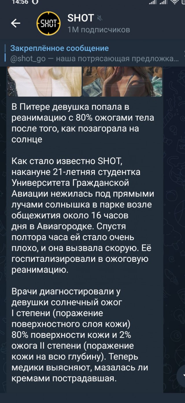 В Питере девушка попала в реанимацию с 80% ожогами тела после того, как позагорала на солнце