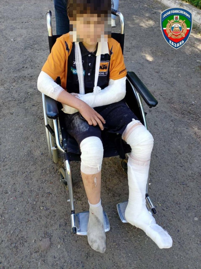 Отец малолетнего питбайкера показал фото сына после ДТП