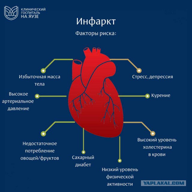Небольшой тест на угрозу инфаркта
